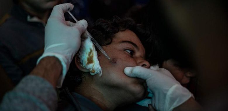داء اللشمانيا ينهش أجساد الصغار والكبار في شمال سوريا